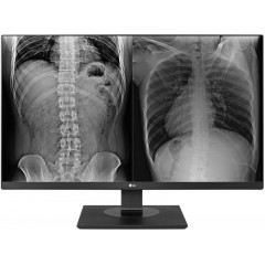 LG 27HJ713C-B Clinical Review Monitor - LED monitor - 8MP - colour - 27" - 3840 x 2160 4K - IPS - 350 cd/m - 1000:1 - 14 ms - 2xHDMI, DisplayPort